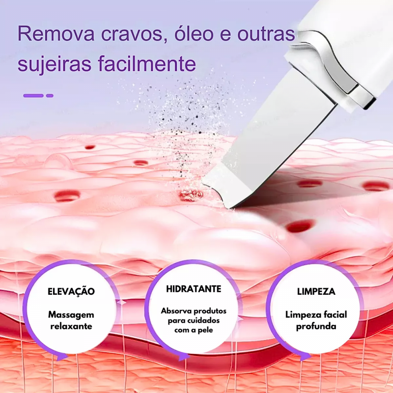 Caneta Peeling Ultrassônico E Ionização Portátil Anti Cravos E Acne EL-1931 Marca: Eletromex